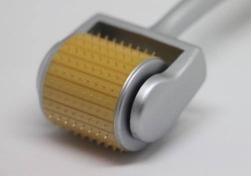 Enhance Recovery with Microneedling and Physical Therapy